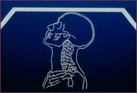 Illustration of Neck Injuries During a Car Accident